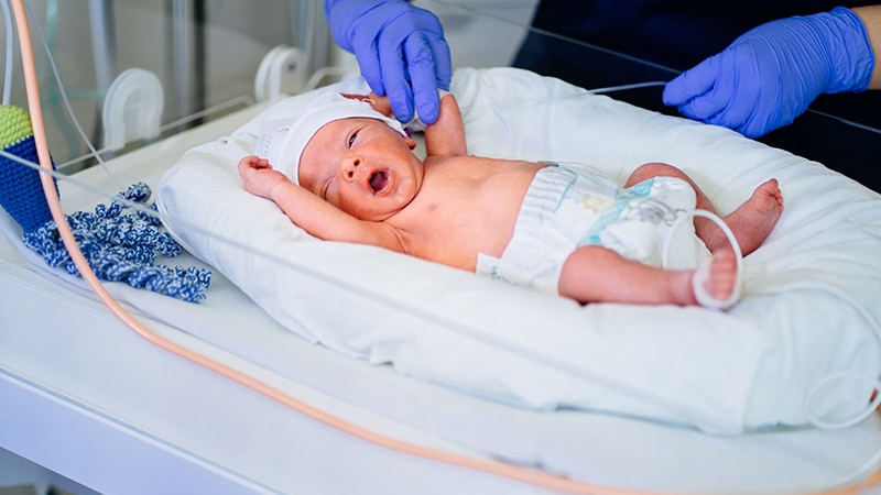 Tanda dan Ciri Ciri Bayi Prematur Sehat yang Perlu Diketahui